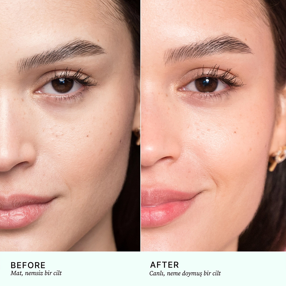 Hyaluronik Asit Serum